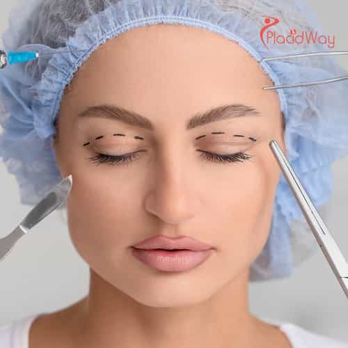 Нитевой лифтинг в корейских клиниках для деликатного, нехирургического подтягивания кожи лица.